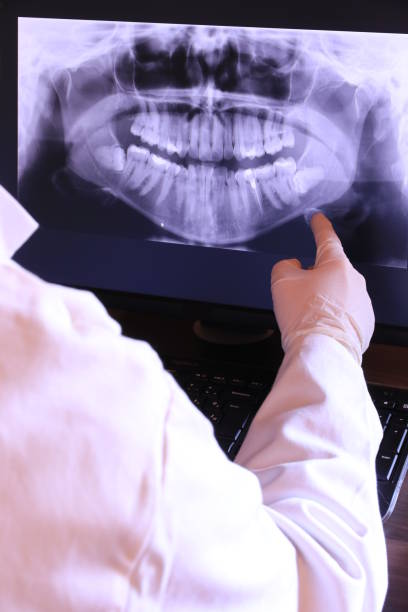 Best Emergency Wisdom Tooth Extraction in Reedley, CA